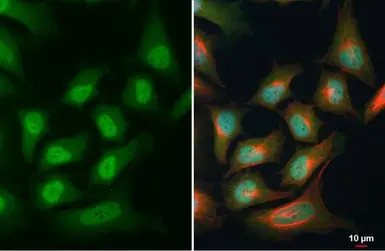 Anti-PAX6 antibody used in Immunocytochemistry/ Immunofluorescence (ICC/IF). GTX113241