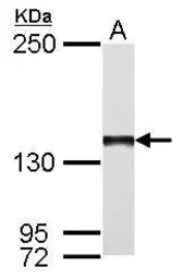 Anti-DNA polymerase gamma antibody [N1N2], N-term used in Western Blot (WB). GTX113247