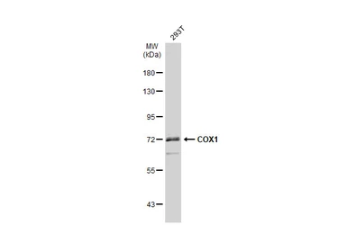 Anti-COX1 antibody used in Western Blot (WB). GTX113259