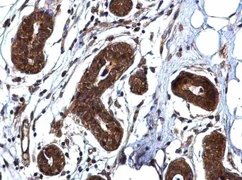 Anti-ROCK1 antibody [N1N2], N-term used in IHC (Paraffin sections) (IHC-P). GTX113266