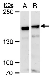 Anti-ROCK1 antibody [N1N2], N-term used in Western Blot (WB). GTX113266