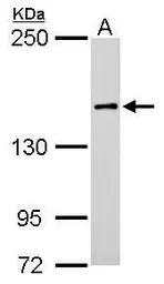 Anti-ROCK1 antibody [N1N2], N-term used in Western Blot (WB). GTX113266