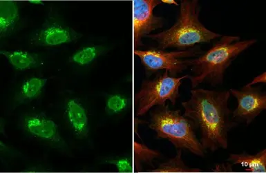 Anti-ROCK1 antibody [N1N2], N-term used in Immunocytochemistry/ Immunofluorescence (ICC/IF). GTX113266