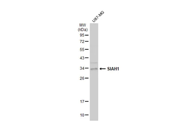 Anti-SIAH1 antibody used in Western Blot (WB). GTX113268