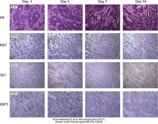 Anti-Thymidine Kinase 1 antibody used in IHC (Paraffin sections) (IHC-P). GTX113281