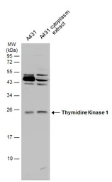 Anti-Thymidine Kinase 1 antibody used in Western Blot (WB). GTX113281