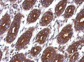 Anti-Thymidine Kinase 1 antibody used in IHC (Paraffin sections) (IHC-P). GTX113281