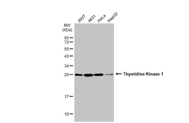 Anti-Thymidine Kinase 1 antibody used in Western Blot (WB). GTX113281