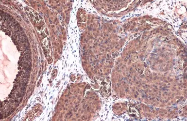 Anti-Thymidine Kinase 1 antibody used in IHC (Paraffin sections) (IHC-P). GTX113281