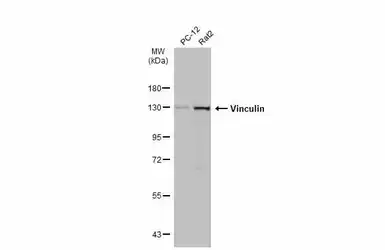 Anti-Vinculin antibody [N1N3] used in Western Blot (WB). GTX113294