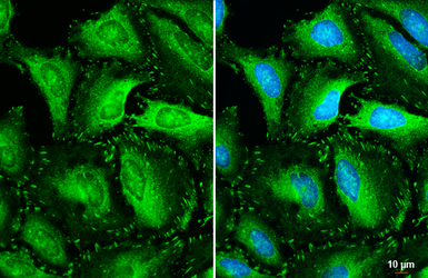 Anti-Vinculin antibody [N1N3] used in Immunocytochemistry/ Immunofluorescence (ICC/IF). GTX113294