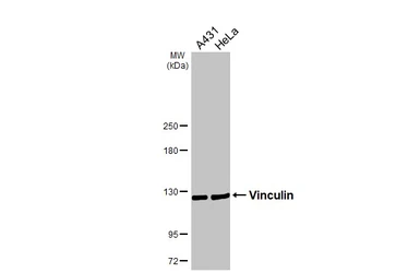 Anti-Vinculin antibody [N1N3] used in Western Blot (WB). GTX113294