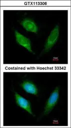 Anti-AIF antibody [N1C1] used in Immunocytochemistry/ Immunofluorescence (ICC/IF). GTX113306