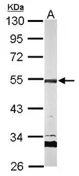 Anti-AP2M1 antibody used in Western Blot (WB). GTX113332