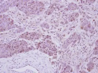 Anti-Casein Kinase 2 beta antibody used in IHC (Paraffin sections) (IHC-P). GTX113335