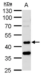 Anti-MST3 antibody [N2C1], Internal used in Western Blot (WB). GTX113371