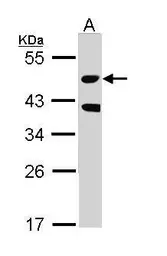 Anti-MST3 antibody [N2C1], Internal used in Western Blot (WB). GTX113371