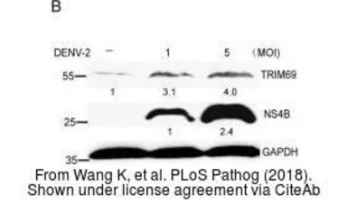 Anti-Dengue virus Type 2 NS4B protein antibody used in Western Blot (WB). GTX113374