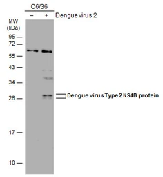 Anti-Dengue virus Type 2 NS4B protein antibody used in Western Blot (WB). GTX113374