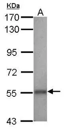 Anti-ALDH2 antibody [N1C1] used in Western Blot (WB). GTX113379
