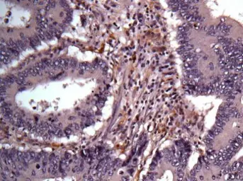Anti-AKR1B1 antibody [N1C3] used in IHC (Paraffin sections) (IHC-P). GTX113381