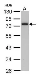Anti-Calpain 3 antibody [C1C3] used in Western Blot (WB). GTX113398