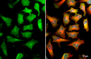 Anti-CBS antibody used in Immunocytochemistry/ Immunofluorescence (ICC/IF). GTX113400
