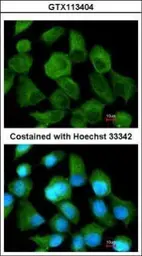 Anti-TPP1 antibody [N1C1] used in Immunocytochemistry/ Immunofluorescence (ICC/IF). GTX113404