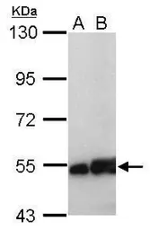 Anti-NSE antibody [C1C3] used in Western Blot (WB). GTX113428