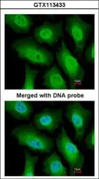 Anti-FANCA antibody [N1], N-term used in Immunocytochemistry/ Immunofluorescence (ICC/IF). GTX113433