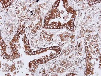 Anti-HLA-DQB1 antibody used in IHC (Paraffin sections) (IHC-P). GTX113458