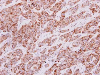 Anti-IDH3G antibody used in IHC (Paraffin sections) (IHC-P). GTX113467