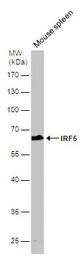 Anti-IRF5 antibody [N1C1] used in Western Blot (WB). GTX113477