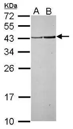 Anti-RPSA antibody [N2C3] used in Western Blot (WB). GTX113485