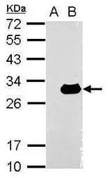Anti-Galectin 3 antibody used in Western Blot (WB). GTX113486