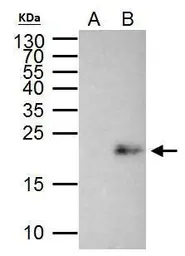 Anti-MAX antibody used in Immunoprecipitation (IP). GTX113492