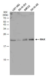 Anti-MAX antibody used in Western Blot (WB). GTX113492
