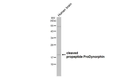 Anti-ProDynorphin antibody [N1C2] used in Western Blot (WB). GTX113515