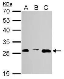 Anti-PSMA3 antibody used in Western Blot (WB). GTX113529
