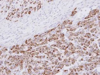 Anti-PSMA3 antibody used in IHC (Paraffin sections) (IHC-P). GTX113529