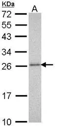 Anti-PSMA3 antibody used in Western Blot (WB). GTX113529