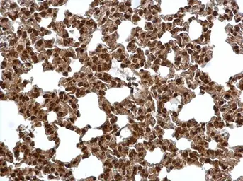Anti-PSMA6 antibody used in IHC (Paraffin sections) (IHC-P). GTX113530