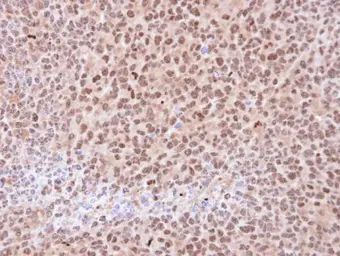 Anti-PSMA6 antibody used in IHC (Paraffin sections) (IHC-P). GTX113530
