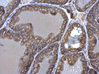Anti-Seryl-tRNA synthetase antibody [N1C2] used in IHC (Paraffin sections) (IHC-P). GTX113546