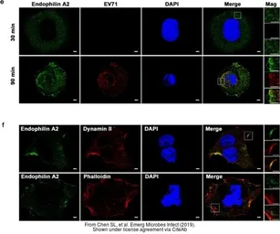 Anti-SH3GL1 antibody [N3C3] used in Immunocytochemistry/ Immunofluorescence (ICC/IF). GTX113548