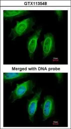 Anti-SH3GL1 antibody [N3C3] used in Immunocytochemistry/ Immunofluorescence (ICC/IF). GTX113548