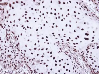 Anti-SSB antibody used in IHC (Paraffin sections) (IHC-P). GTX113555