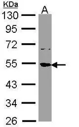 Anti-SSB antibody used in Western Blot (WB). GTX113555