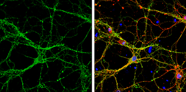 Anti-Syntaxin 1a antibody used in Immunocytochemistry/ Immunofluorescence (ICC/IF). GTX113559