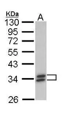 Anti-SULT1A1 antibody used in Western Blot (WB). GTX113560